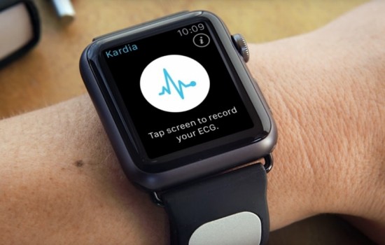 Apple Watch 4 сможет снимать кардиограмму сердца