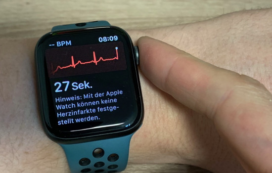 Apple Watch показали проблемы с сердцем, которые не выявило медицинское оборудование 