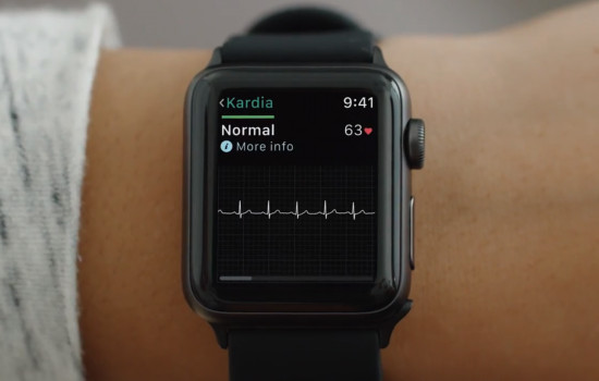 В Apple Watch появятся новые функции, спасающие жизнь